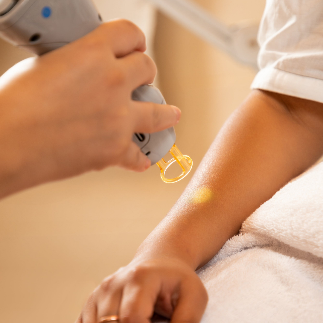 Diode Laser Hair Removal Process